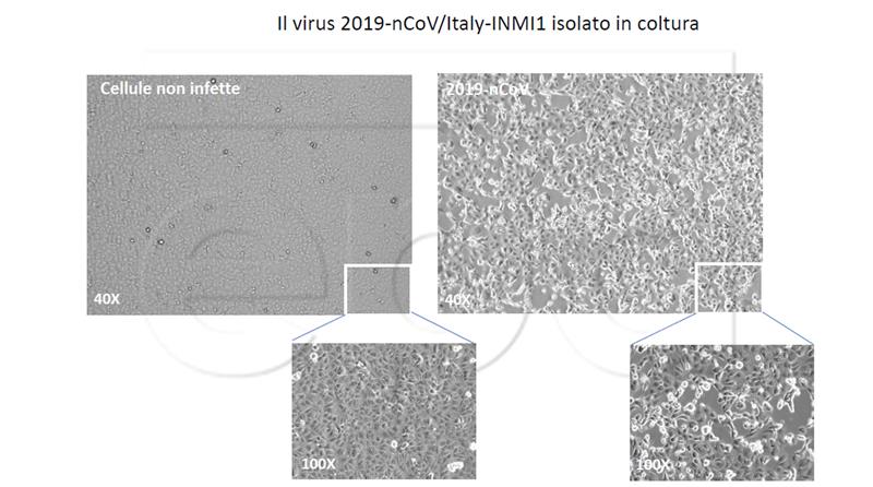 ITALY HEALTH CORONAVIRUS