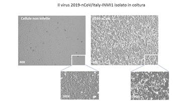 Znanstvenici u Rimu izolirali koronavirus