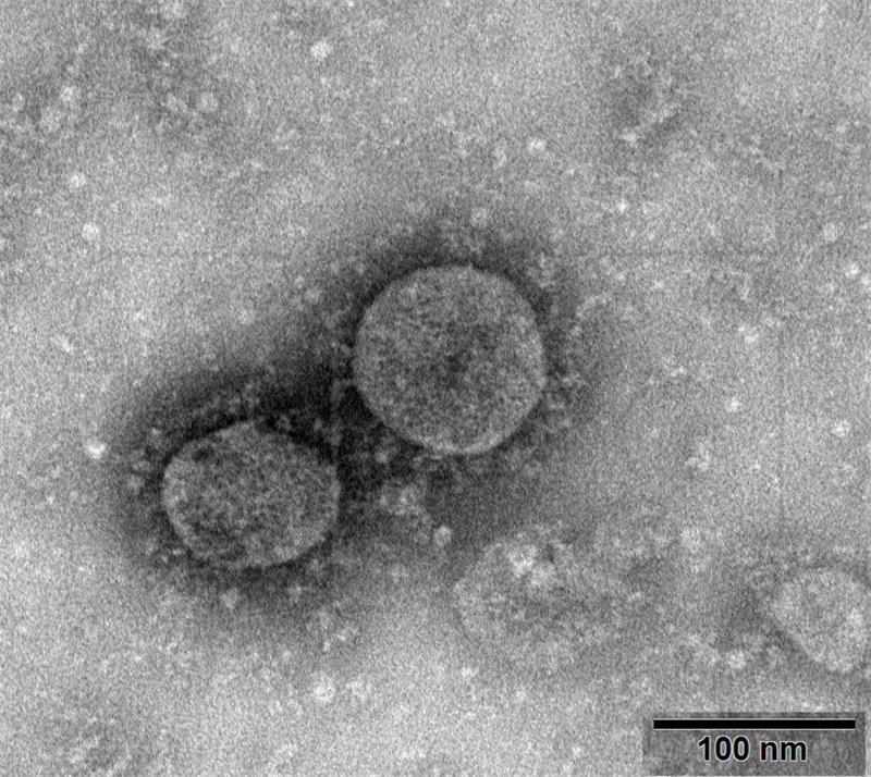 Koronavirus mutira i ima osam tipova, kažu stručnjaci