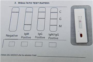 Kompanije Jemenu poklanjaju nekoliko desetaka tisuća kompleta testova