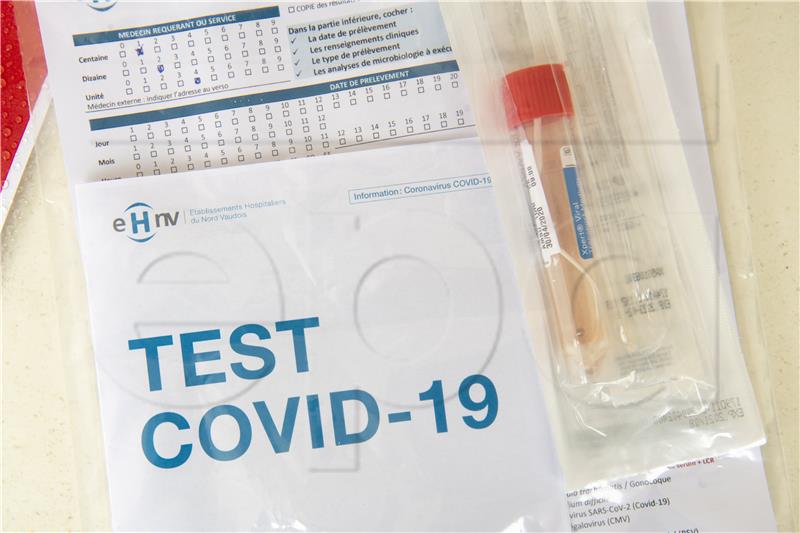 Sjedinjene Države odobrile prvi kućni test sline za covid-19