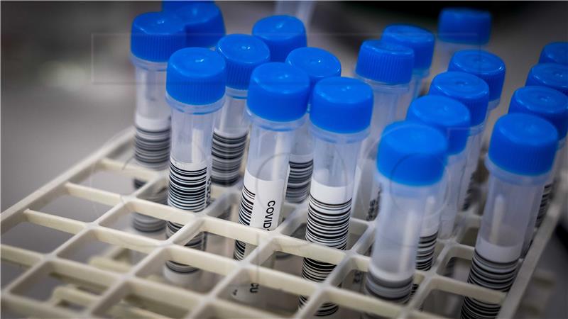 NETHERLANDS CORONAVIRUS PANDEMIC TEST