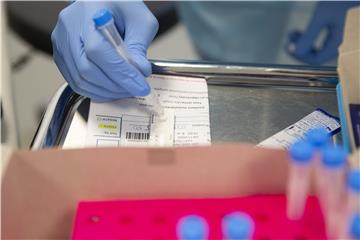 SWITZERLAND CORONAVIRUS COVID-19 PCR TEST