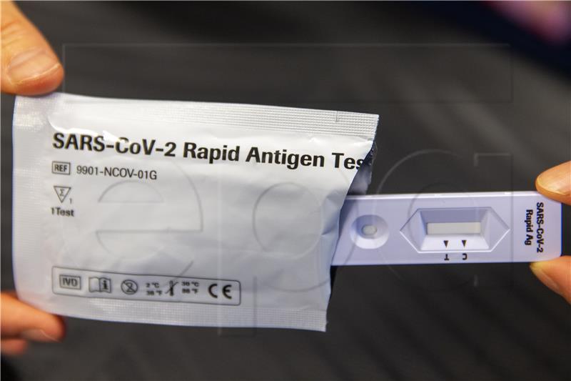 SWITZERLAND CORONAVIRUS COVID-19 PCR TEST