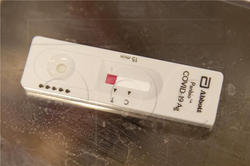 SWITZERLAND CORONAVIRUS COVID-19 PCR TEST