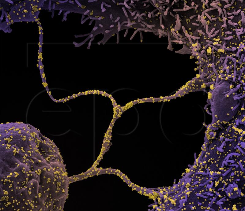 USA HEALTH CORONAVIRUS COVID19