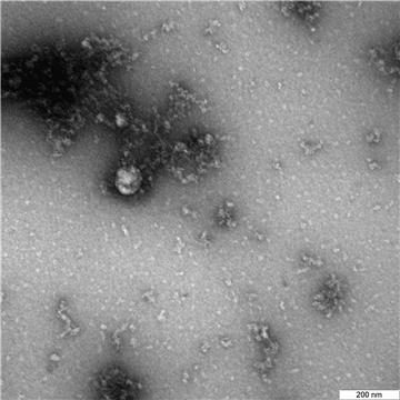 RUSSIA HEALTH CORONAVIRUS BRITISH STRAIN IMAGE