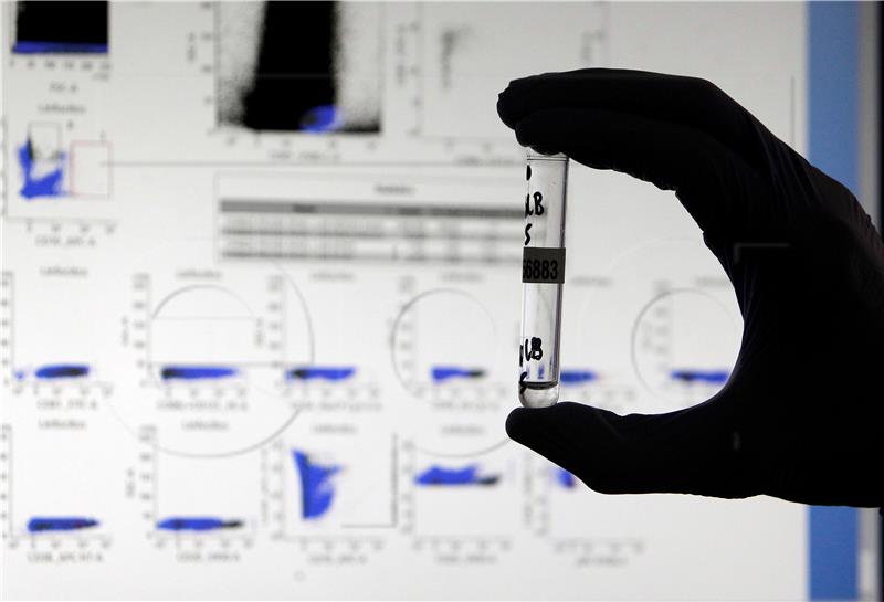 epaselect SPAIN RESEARCH PANDEMIC CORONAVIRUS COVID19