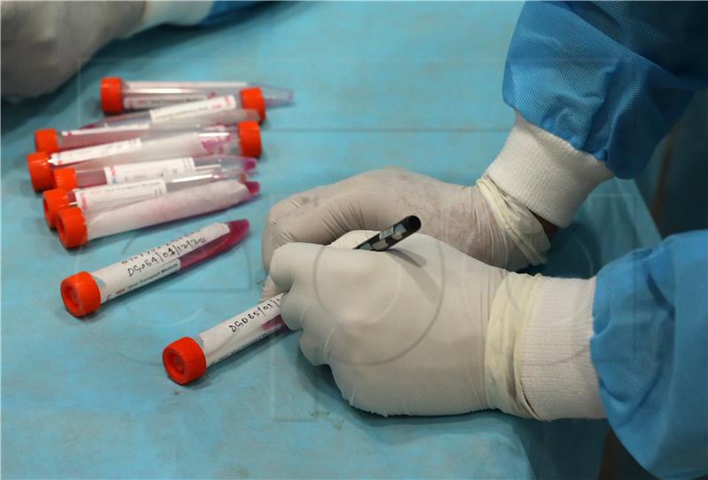 Croatia reports 87 new coronavirus cases, no deaths in last 24 hours