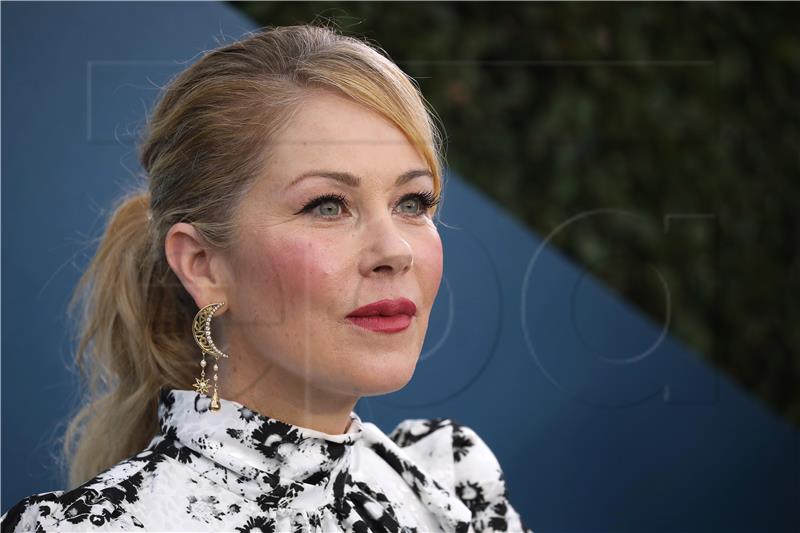 Američka glumica Christina Applegate oboljela od multiple skleroze