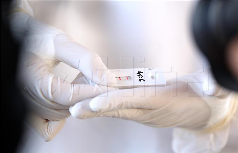 Rapid antigen testing no longer free in Slovenia