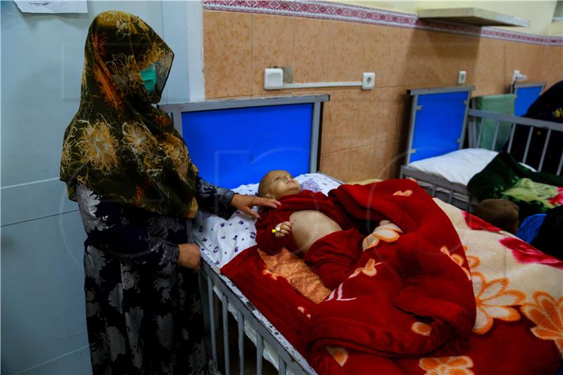 AFGHANISTAN MALNUTRITION