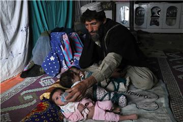 AFGHANISTAN CRISIS HUNGER AND MALNUTRITION