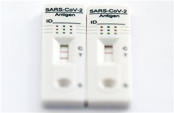 Brzi antigenski test SARS-Cov-2 za samotestiranje