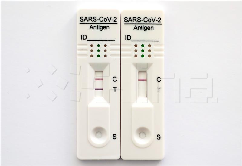 Brzi antigenski test SARS-Cov-2 za samotestiranje