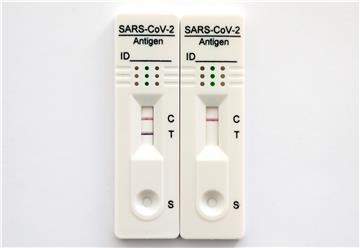 Brzi antigenski test SARS-Cov-2 za samotestiranje