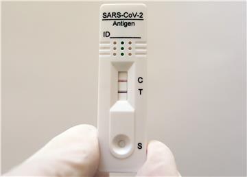 Brzi antigenski test SARS-Cov-2 za samotestiranje