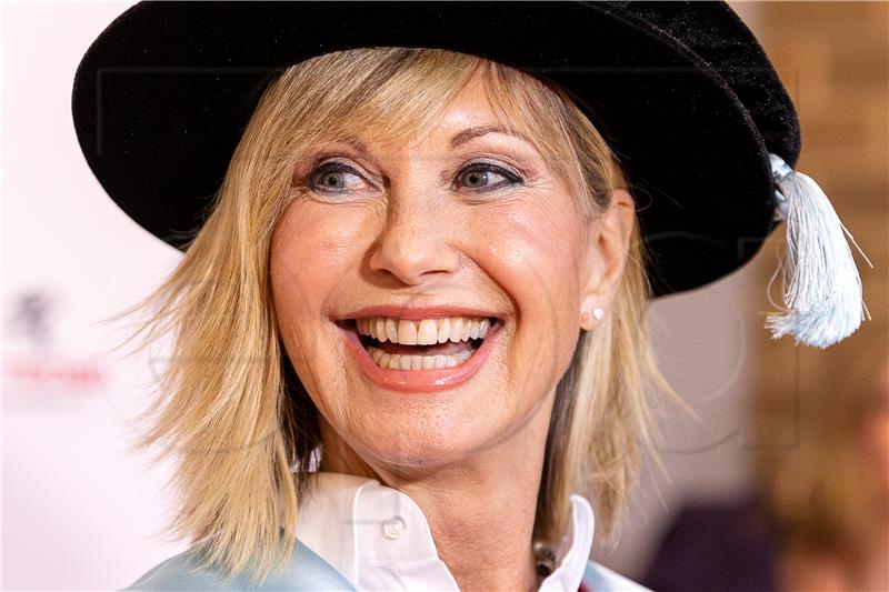 Umrla zvijezda "Briljantina" Olivia Newton-John