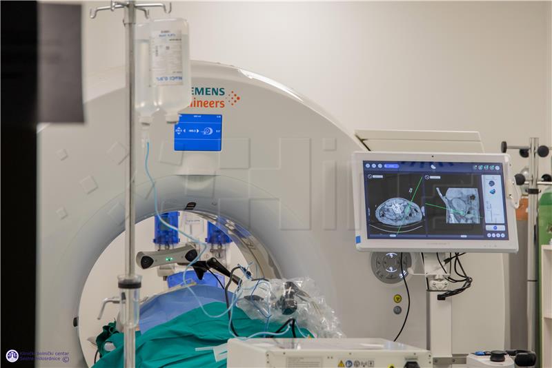 Croatia's first tumor ablation and biopsy procedures performed using robotic arm