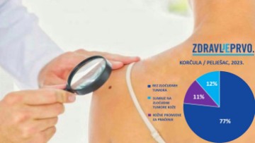 Javnozdravstvena akcija na Korčuli i Pelješcu: Utvrđena sumnja na 35 melanoma 