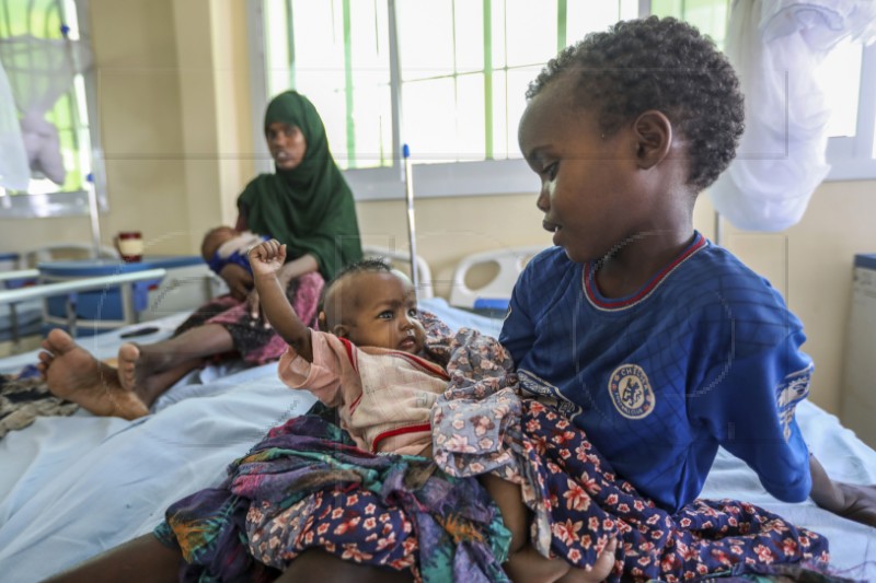 SOMALIA PHOTO SET MALNUTRITION