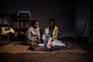 MOZAMBIQUE PHOTO SET ALBINISM