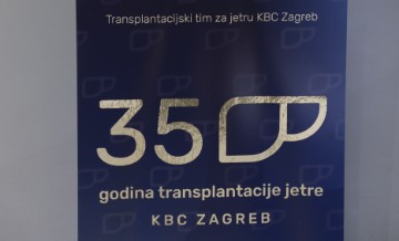 Obilježavanje 35 godina transplantacije jetre