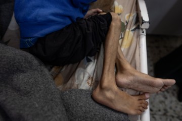 MIDEAST GAZA ISRAEL PALESTINIANS CONFLICT