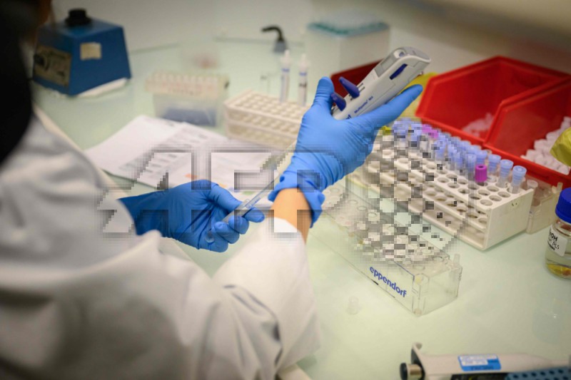 Krvni test otkriva znakove Alzheimera 'desetljećima prije simptoma' - studija