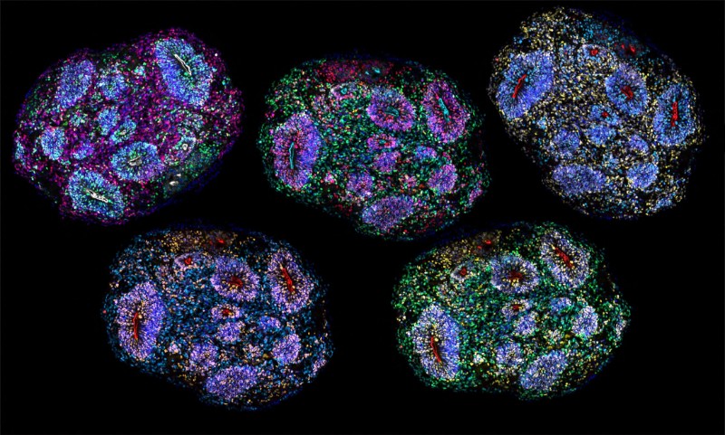 US-SCIENCE-HEALTH-DRUGS