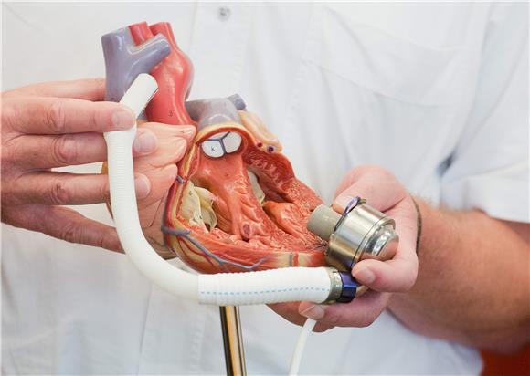 GERMANY MEDICINE ARTIFICIAL HEART