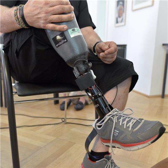 AUSTRIA PROSTHETIC LEG