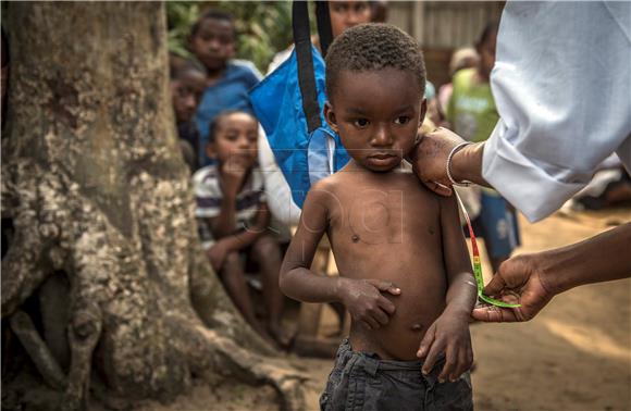 MADAGASCAR MALNUTRITION