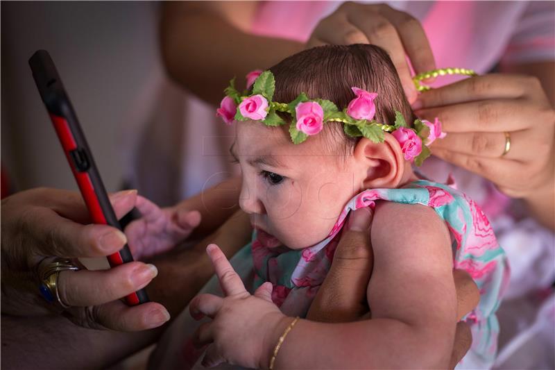 BRAZIL MICROCEPHALY