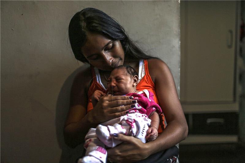 BRAZIL ZIKA RAISING MICROCEPHALY CHILD