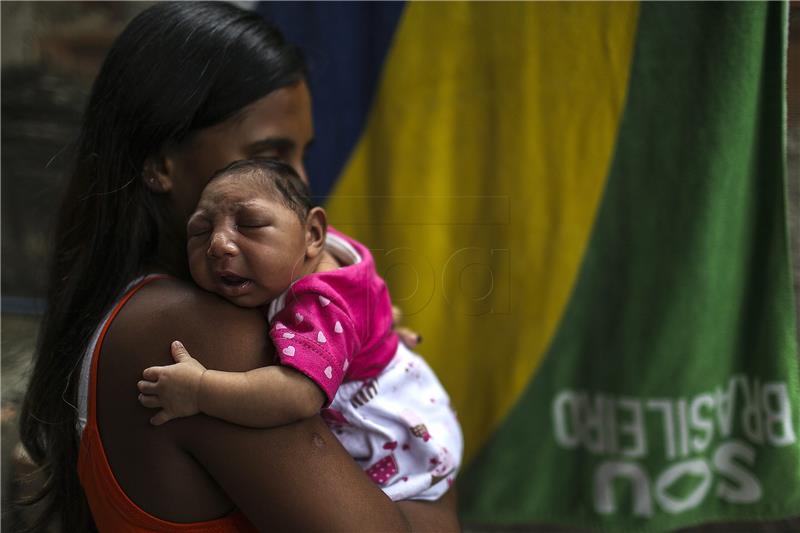 BRAZIL ZIKA RAISING MICROCEPHALY CHILD