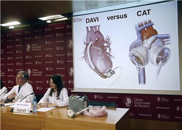 SPAIN MEDICINE ARTIFICIAL HEART