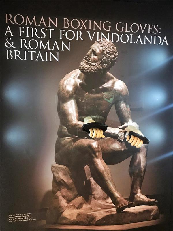 BRITAIN ARCHEOLOGY ROMAN BOXING GLOVES