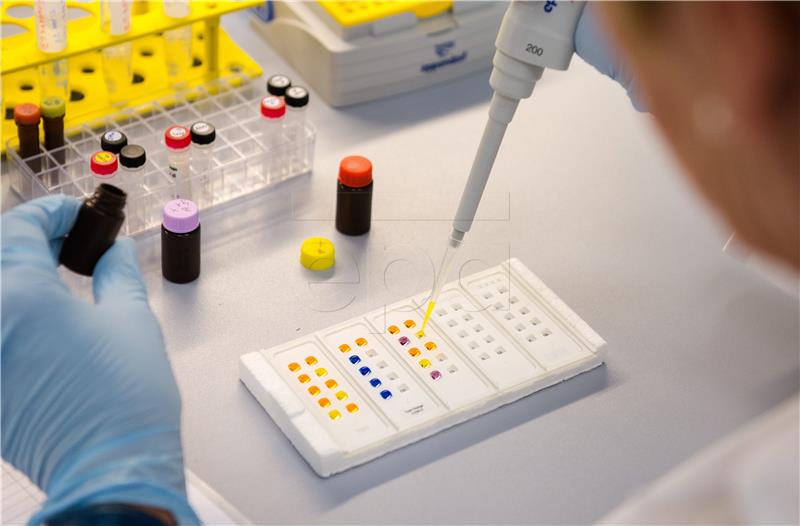 Zagreb hospital for children's diseases gets laboratory for acute lymphoblastic leukaemia