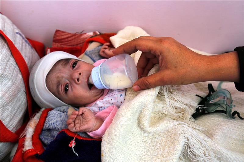 YEMEN CONFLICT MALNUTRITION