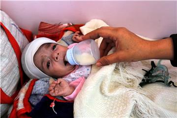 YEMEN CONFLICT MALNUTRITION