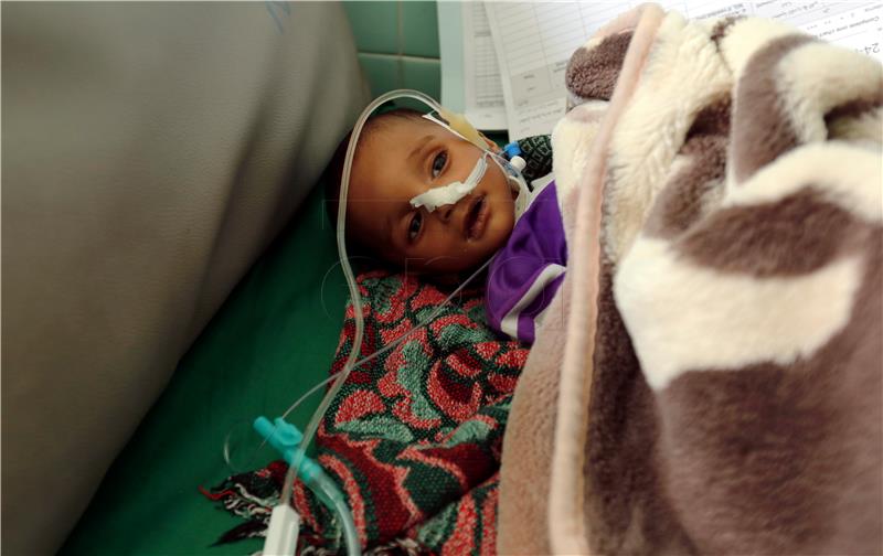 (FILE) YEMEN CONFLICT MALNUTRITION